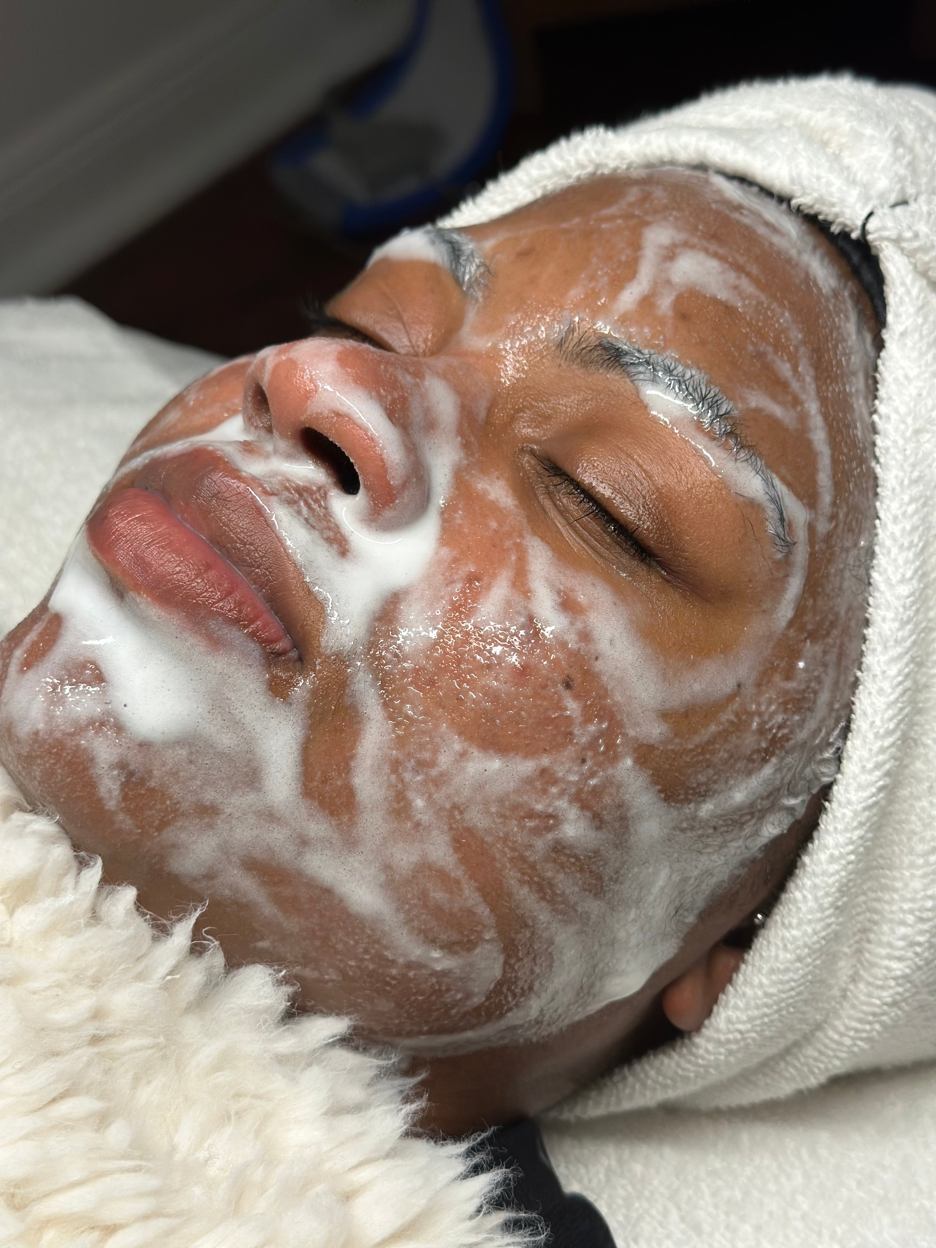 Oxygen Facials in New Orleans