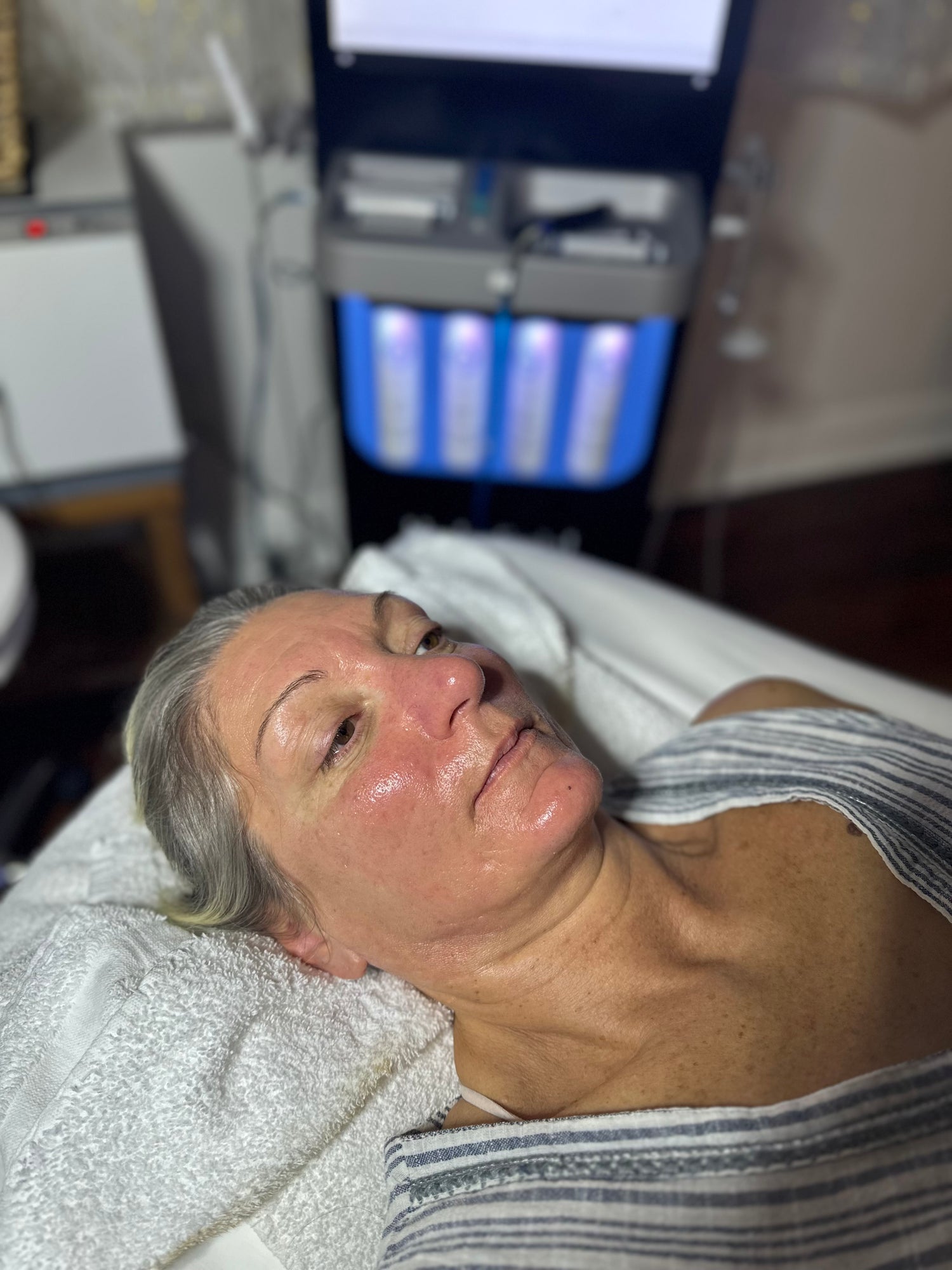 HydraFacial New Orleans